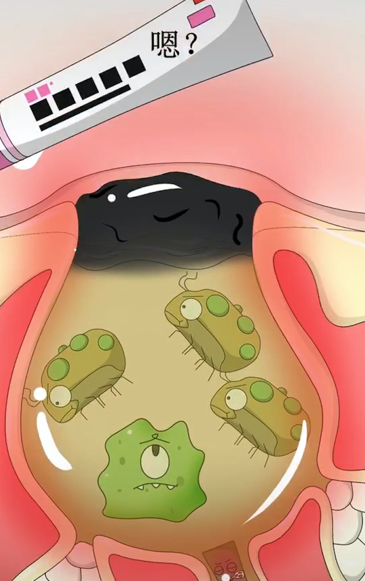 甲硝锉凝胶去黑头，这个操作比较靠谱